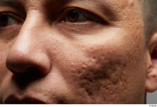 HD Face Skin Dante Pozoz cheek eye face nose scar…